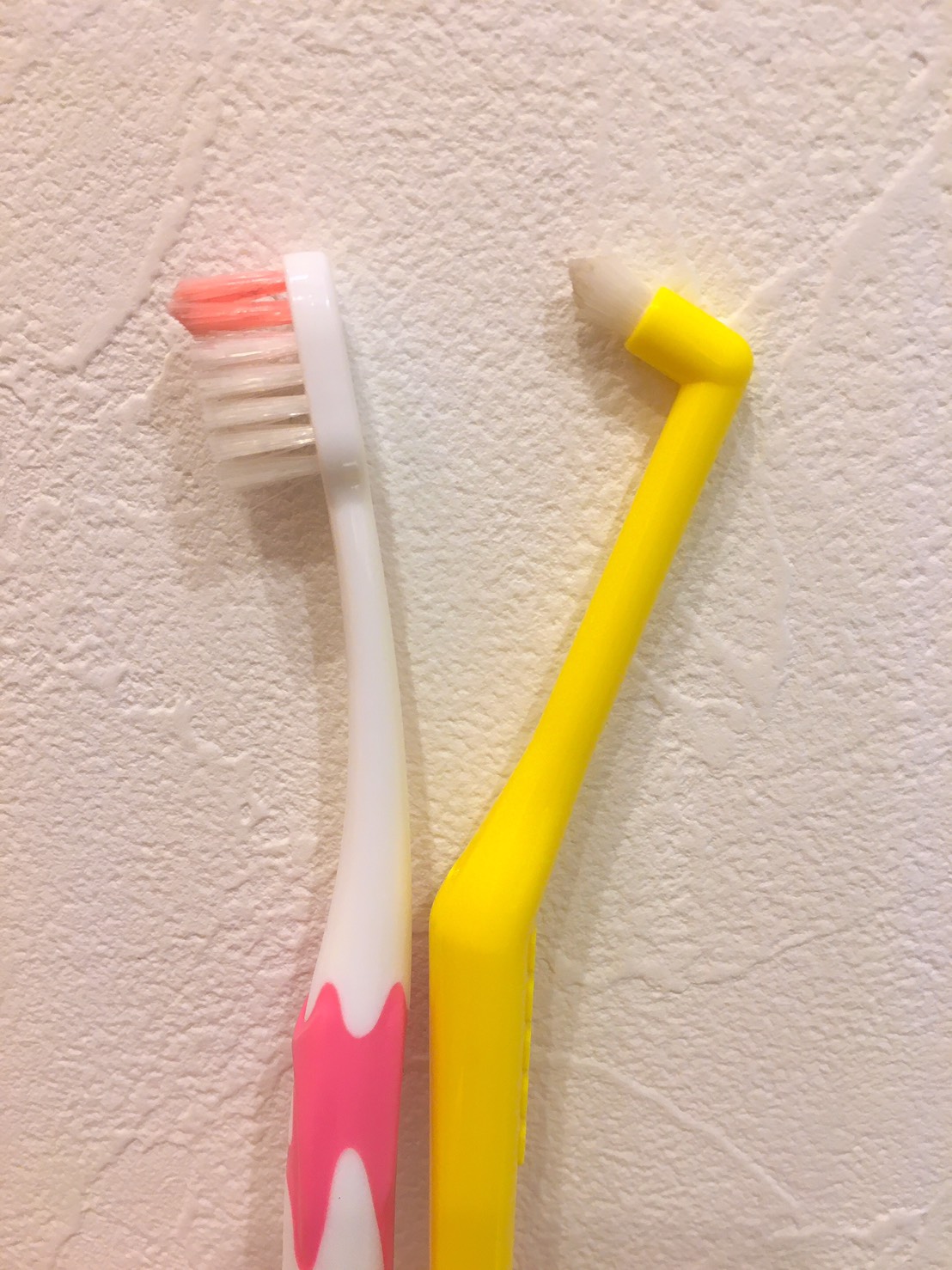 むし歯の原因について