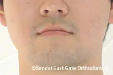 治療前