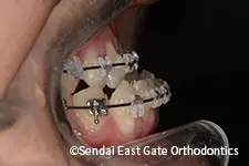 治療中