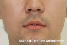 治療後