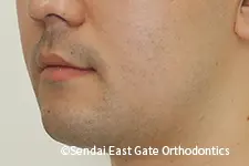 治療後
