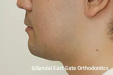 治療後