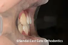 治療後