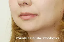 治療後