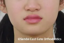 治療前