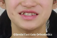 治療前