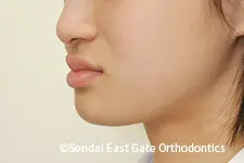 治療後