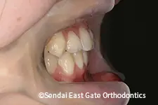 治療後