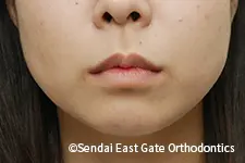 治療後