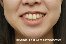 治療後