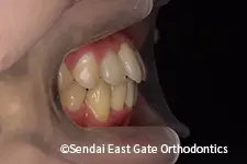治療後