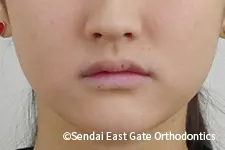治療前