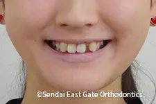治療前