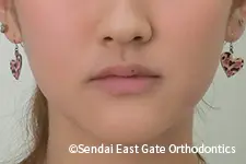 治療後