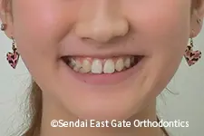 治療後