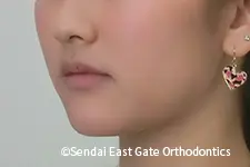 治療後