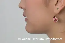 治療後