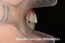 治療後