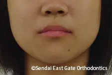 治療前