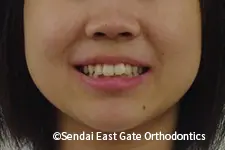 治療前