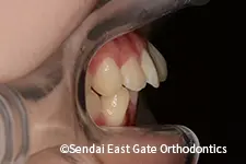 治療前