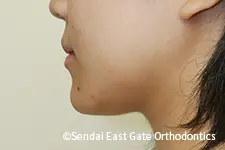 治療後
