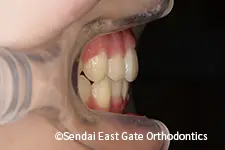 治療後