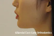 治療前