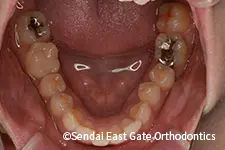 治療前