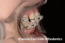 治療中