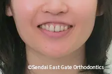 治療後