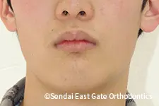 治療前