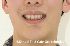治療前