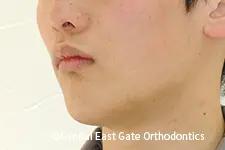 治療前