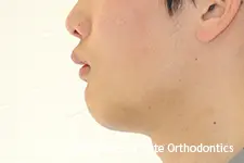 治療前
