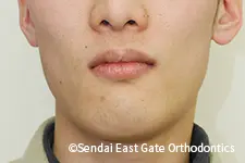 治療後