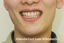 治療後
