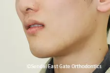 治療後