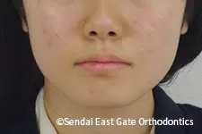 治療前
