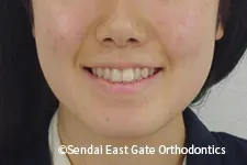 治療前