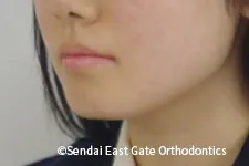 治療前
