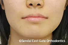 治療後