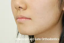 治療後