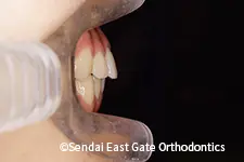 治療後