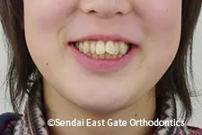 治療前