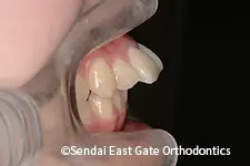 治療前