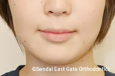 治療後