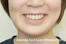 治療後