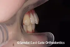 治療後