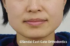 治療前